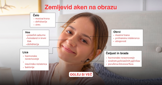 Zemljevid obraza pri aknah po conah