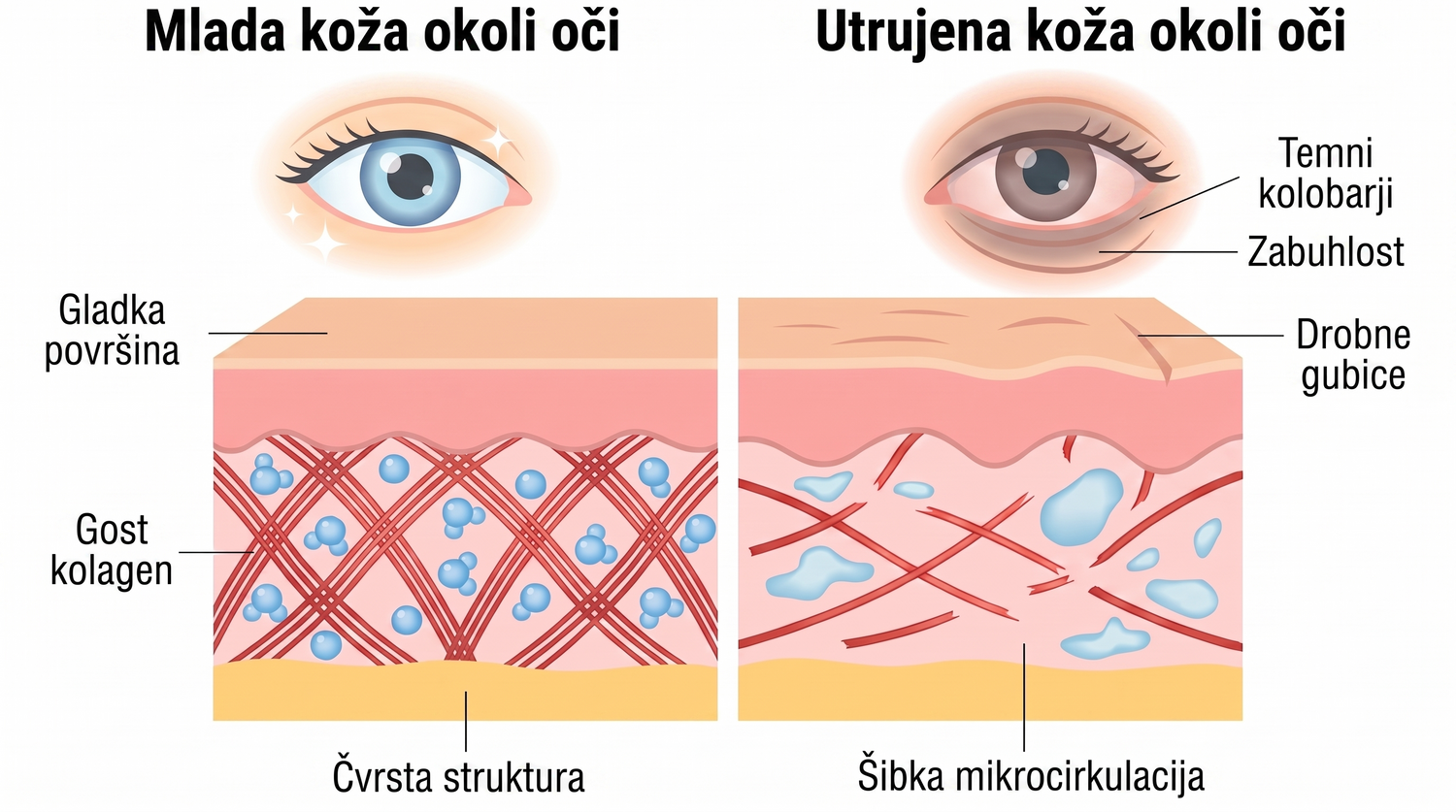 Rose Eye Lift SI eyev1