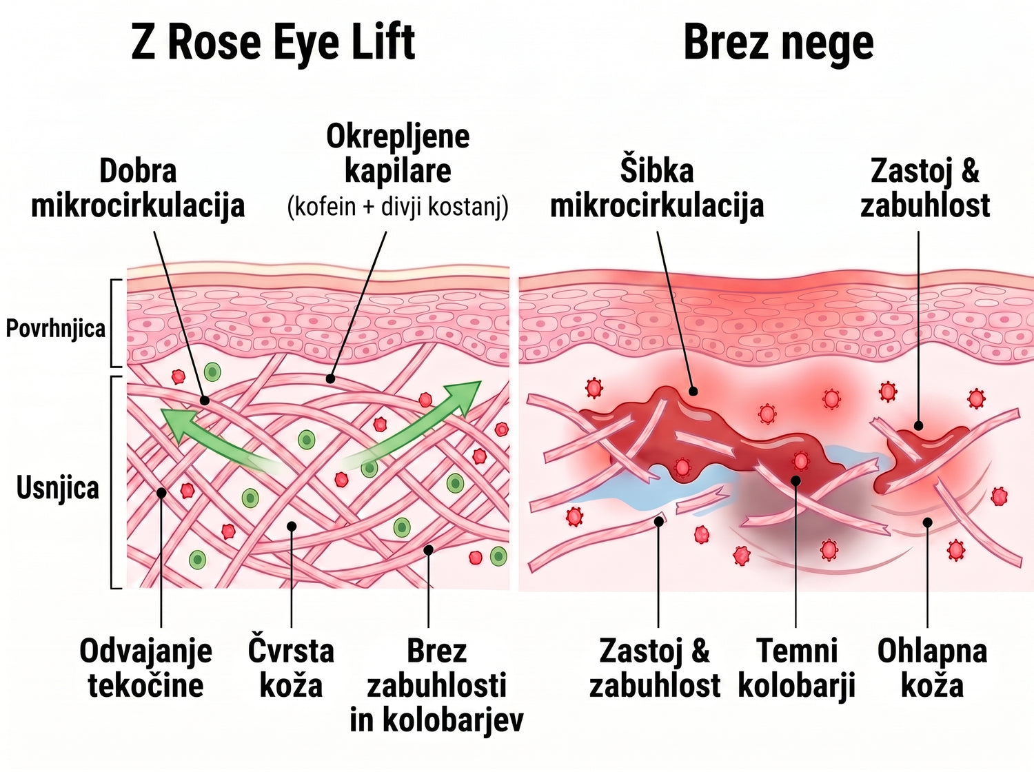 Rose Eye Lift SI t17