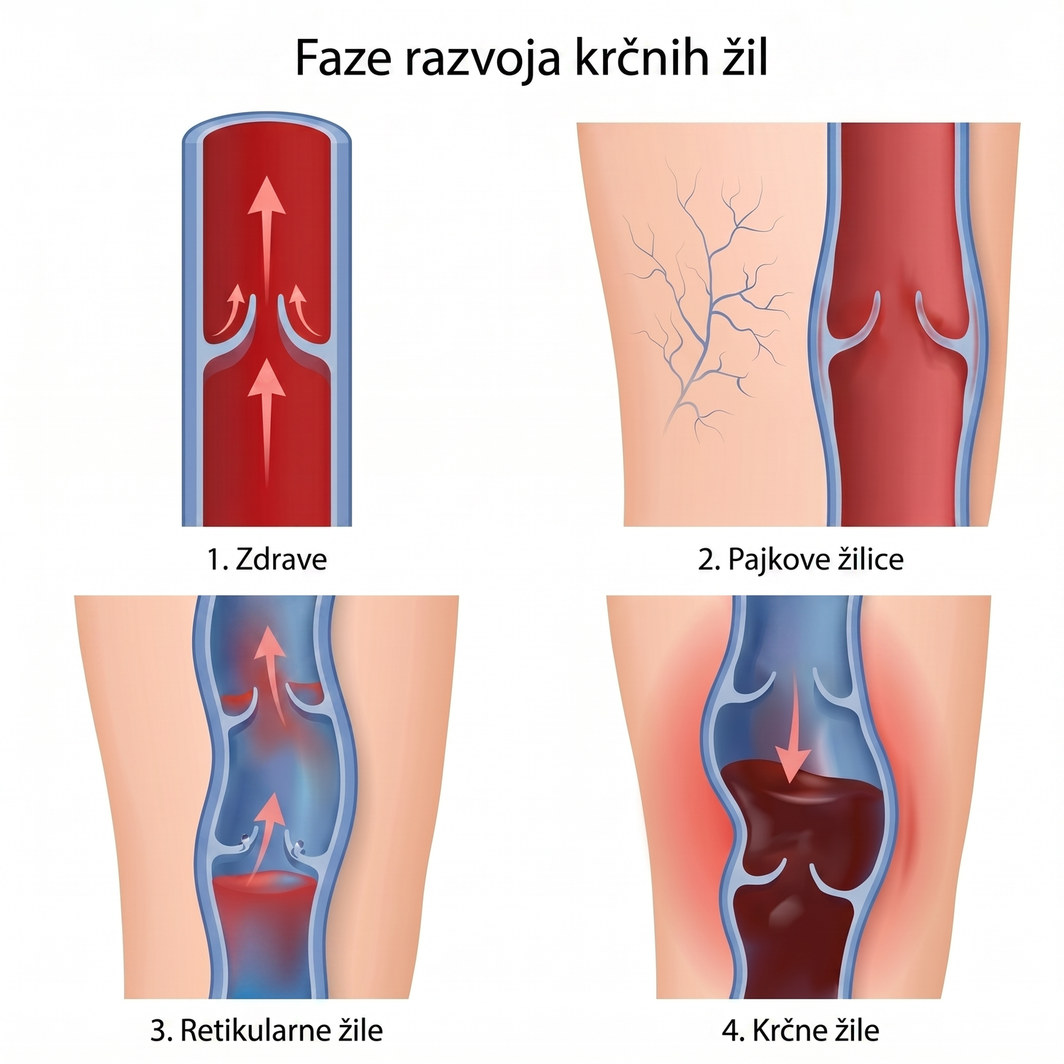 shutterstock_4stages