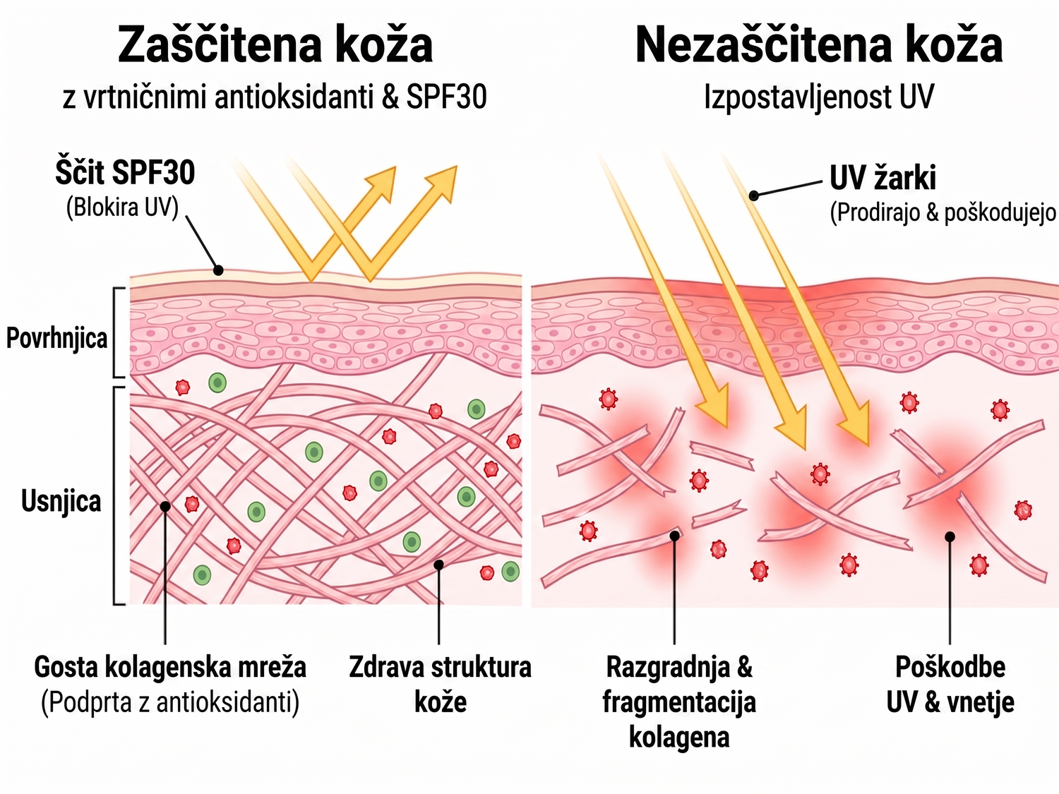 spf SI infographic