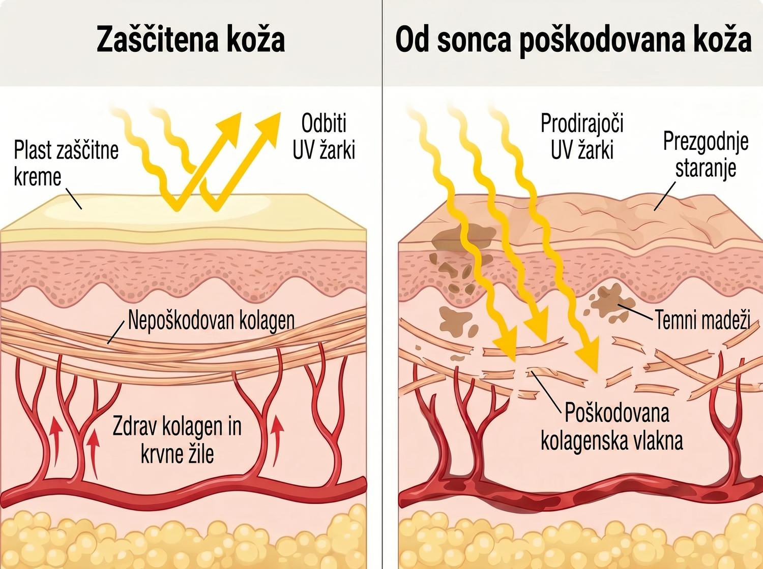 spf SI infographic